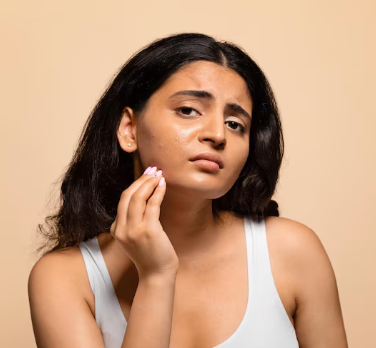 Pigmentation-Control